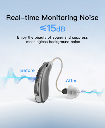 Coniler Rechargeable Bluetooth Hearing Aids, App-Controlled with Noise Cancelling, Tinnitus Masking, Multiple Sound Modes